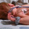 Best-Oximeter-for-neonate-Baby.