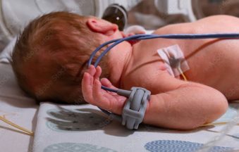 Best-Oximeter-for-neonate-Baby.